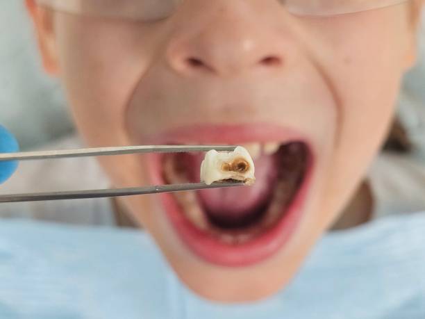 Best Cracked Tooth Emergency Dentist  in Elk City, OK